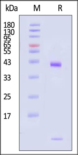 ACROBiosystems Human HLA-B1501 B2M 200ug, Quantity: Each of 1