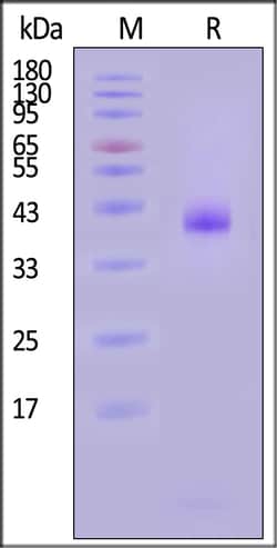 ACROBiosystems Human HLA-B0801 B2M 25ug, Quantity: Each of 1