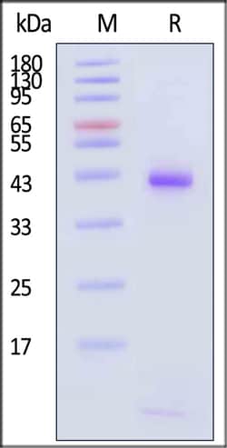 ACROBiosystems Human HLA-B0702 B2M 200ug, Quantity: Each of 1
