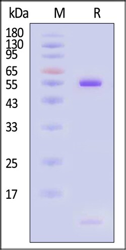 ACROBiosystems&nbsp;Human HLA-A0201B2MPRAME S
