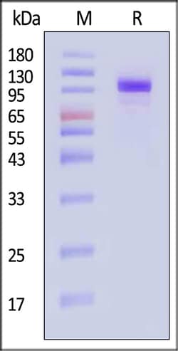 ACROBiosystems Hemagglutinin HA 25ug, Quantity: Each of 1
