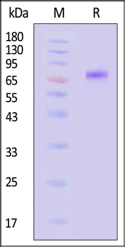 ACROBiosystems Neuraminidase NA 100ug, Quantity: Each of 1