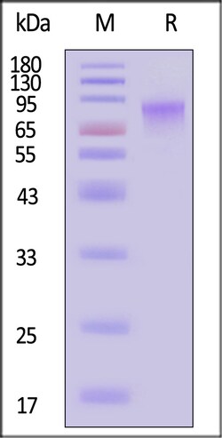 ACROBiosystems Cynomolgus GUCY2C 200ug, Quantity: Each of 1