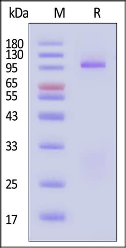 ACROBiosystems gp140 25ug, Quantity: Each of 1