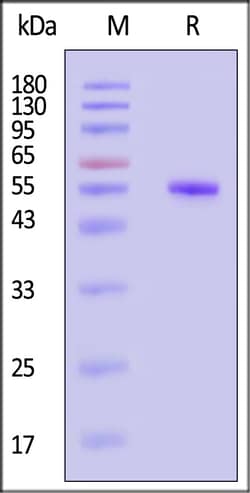 ACROBiosystems SFTS virus Gn protein 50ug, Quantity: Each of 1