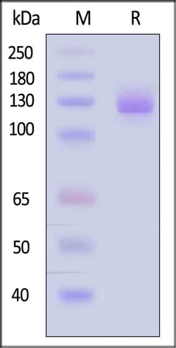 ACROBiosystems Human VCAM-1 1mg, Quantity: Each of 1