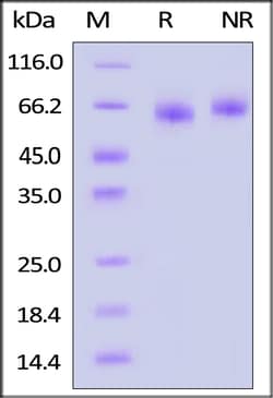 ACROBiosystems Human DLL4 200ug, Quantity: Each of 1