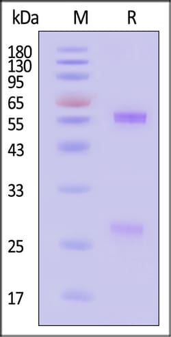 ACROBiosystems Glycoprotein D HSV-2 100ug, Quantity: Each of 1