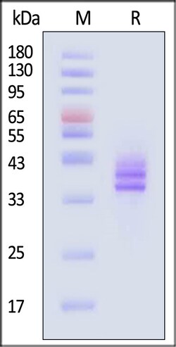 ACROBiosystems Human Follistatin 20ug, Quantity: Each of 1
