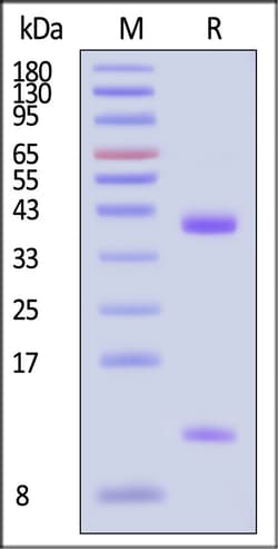 ACROBiosystems Human FcRn FCGRT B2M 50ug, Quantity: Each of 1