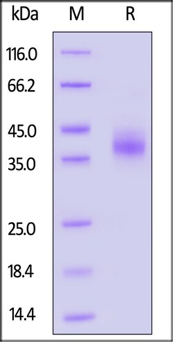 ACROBiosystems Rhesus macaque EpCAM 25ug, Quantity: Each of 1