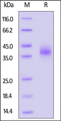 ACROBiosystems Rhesus macaque EpCAM 200ug, Quantity: Each of 1