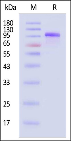 ACROBiosystems Rat Complement C2 25ug, Quantity: Each of 1
