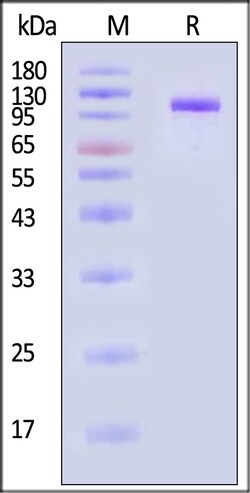 ACROBiosystems Rabbit Complement C2 25ug, Quantity: Each of 1