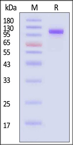ACROBiosystems Complement C2 25ug, Quantity: Each of 1