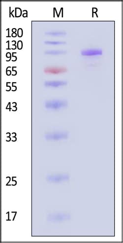 ACROBiosystems Cynomolgus Complement C2 200ug, Quantity: Each of 1