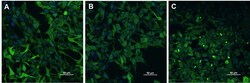 ACROBiosystems&nbsp;Human Alpha-synuclein 2Vials