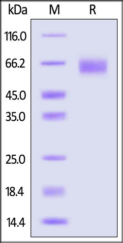 ACROBiosystems Mouse CD47 25ug, Quantity: Each of 1