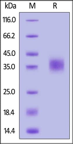 ACROBiosystems Human CD47 His Tag, Quantity: Each of 1