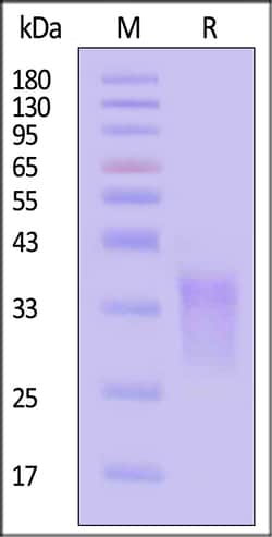 ACROBiosystems Cynomolgus CD7 100ug, Quantity: Each of 1