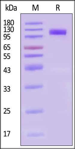 ACROBiosystems Human CD36 25ug, Quantity: Each of 1