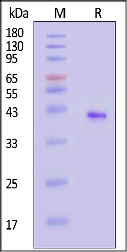 ACROBiosystems Human CD20 20ug, Quantity: Each of 1