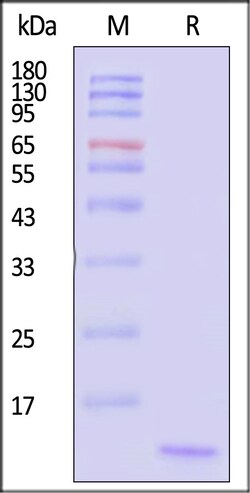 ACROBiosystems&nbsp;Human CCL11 Protein His Tag