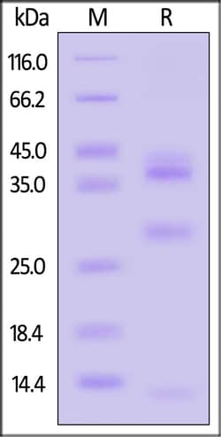 ACROBiosystems Mouse Cathepsin L 20ug, Quantity: Each of 1