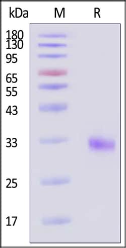 ACROBiosystems Human Cathepsin L 50ug, Quantity: Each of 1