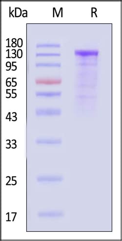 ACROBiosystems Human Cadherin-17 25ug, Quantity: Each of 1