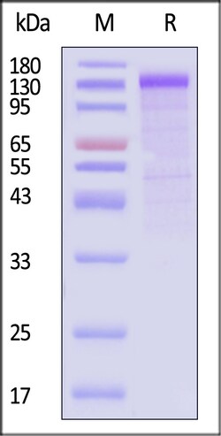 ACROBiosystems Human Cadherin-17 1mg, Quantity: Each of 1