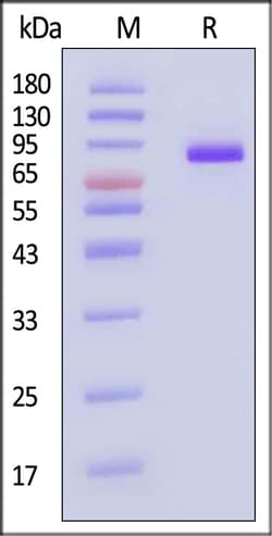 ACROBiosystems beta-Galactosidase-1 100ug, Quantity: Each of 1