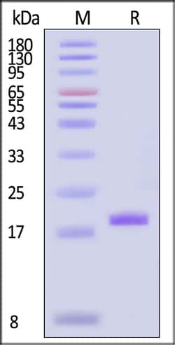 ACROBiosystems Human FGF basic 50ug, Quantity: Each of 1