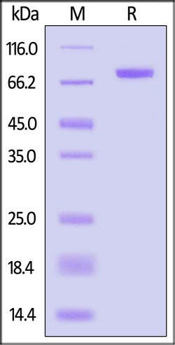 ACROBiosystems beta-Glucuronidase/GUSB 100ug, Quantity: Each of 1