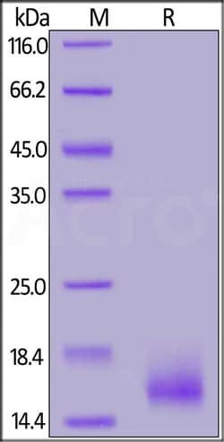 ACROBiosystems BCMA 25ug, Quantity: Each of 1