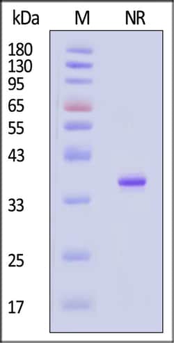 ACROBiosystems Human Annexin A5 200ug, Quantity: Each of 1
