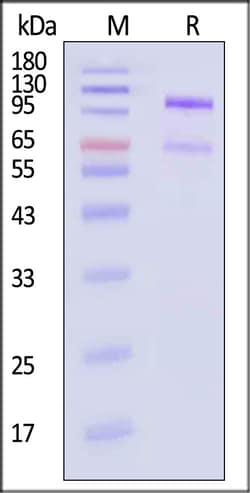 ACROBiosystems Angiopoietin-like 3 100ug, Quantity: Each of 1