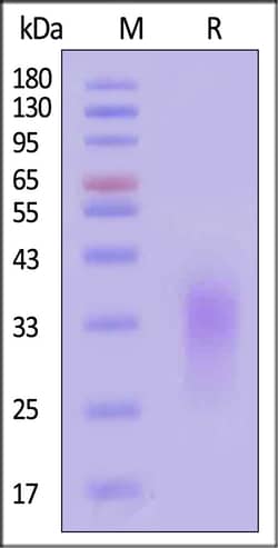 ACROBiosystems Human Activin RIIB 25ug, Quantity: Each of 1