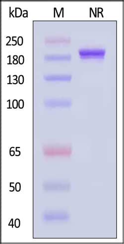 ACROBiosystems Human 4-1BB Ligand 25ug, Quantity: Each of 1