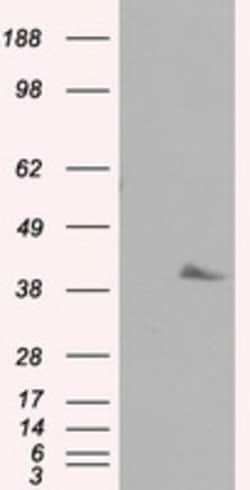 OriGene Pleckstrin (PLEK) Mouse Monoclonal Antibody [Clone ID: OTI2F10],