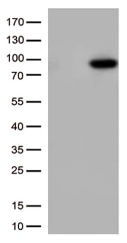 OriGene XRCC1 Mouse Monoclonal Antibody [Clone ID: OTI2H8], Quantity: Each
