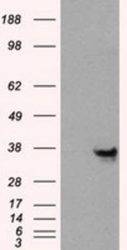 OriGene Annexin A10 (ANXA10) Mouse Monoclonal Antibody [Clone ID: OTI4D8]