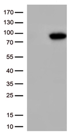 OriGene XRCC1 Mouse Monoclonal Antibody [Clone ID: OTI2E8], Quantity: Each