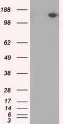 OriGene PASK Mouse Monoclonal Antibody [Clone ID: OTI11D8], Quantity: Each