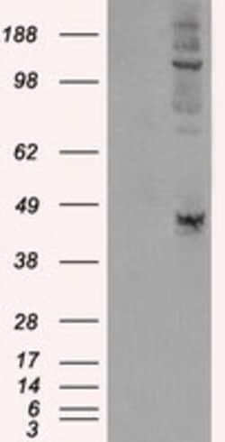 OriGene LOX Mouse Monoclonal Antibody [Clone ID: OTI9A11], Quantity: Each
