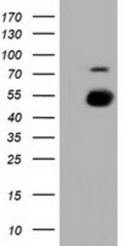 OriGene&nbsp;PKMYT1 Mouse Monoclonal Antibody [Clone ID: OTI1C3]