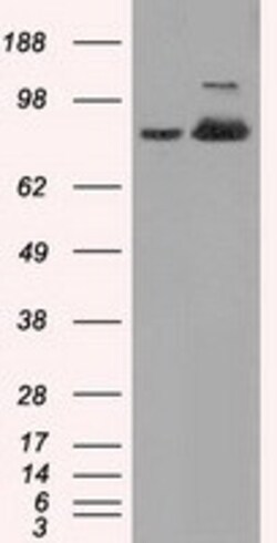 OriGene Aconitase 2 (ACO2) Mouse Monoclonal Antibody [Clone ID: OTI7G4],