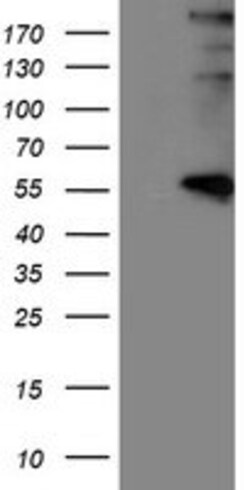 OriGene LOX Mouse Monoclonal Antibody [Clone ID: OTI10D11], Quantity: Each