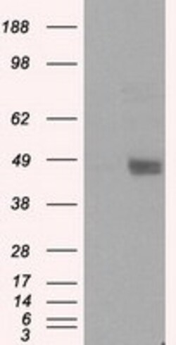 OriGene LOX Mouse Monoclonal Antibody [Clone ID: OTI6B11], Quantity: Each