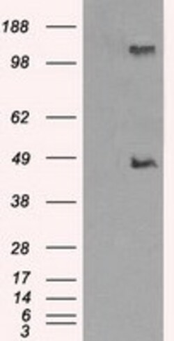 OriGene LOX Mouse Monoclonal Antibody [Clone ID: OTI8G5], Quantity: Each